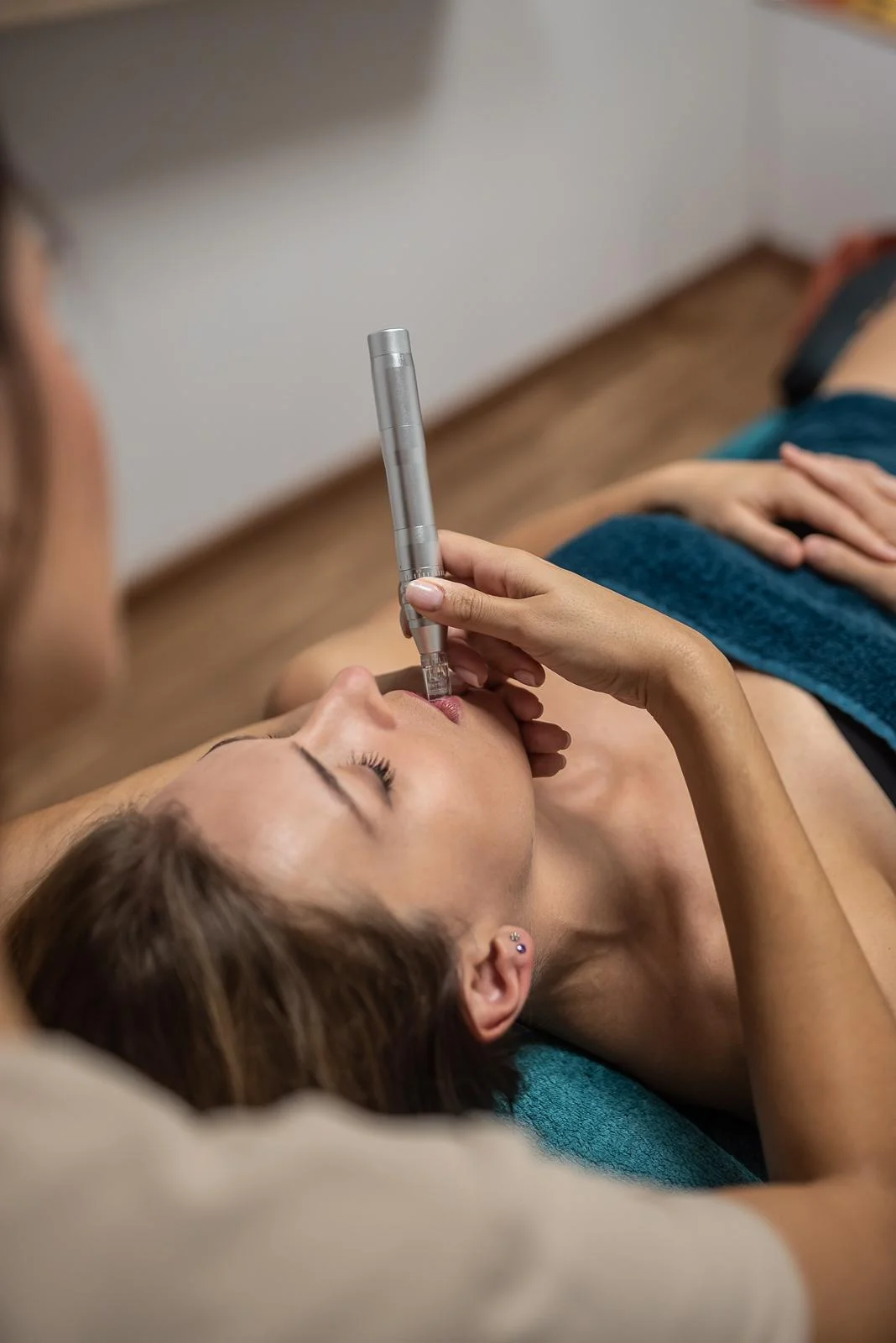 Tratamiento de labios con Dermapen